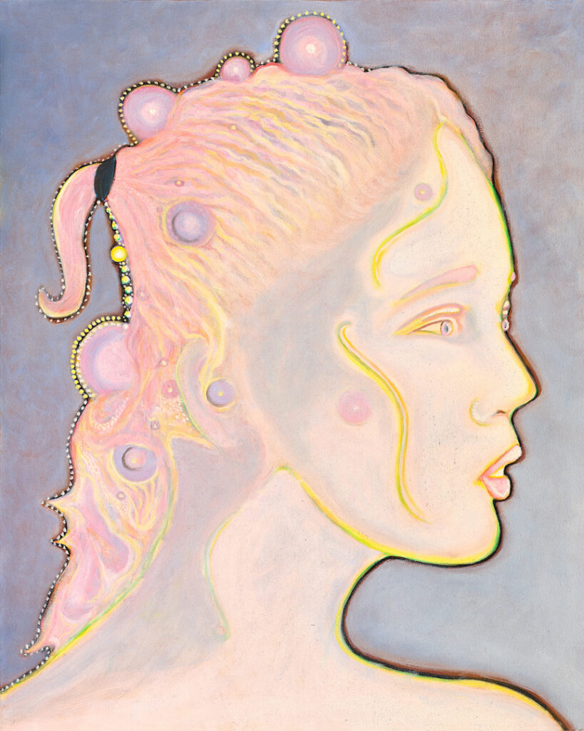 Derrick Montez: Albinism #1